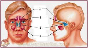 Sinüzit Tedavisi Sinüzit Topu