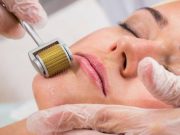 Mezoterapi Nedir? Mezoterapi nedir