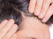 Saç Ekimi Yöntemleri Saç Ekimi Yöntemleri